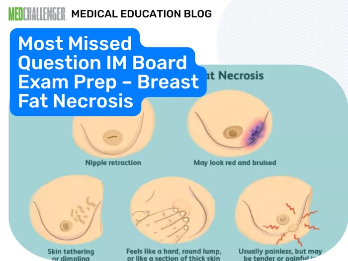 Blog - Most Missed Question IM Board Exam Prep – Breast Fat Necrosis