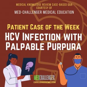 HCV Infection with Palpable Purpura - Patient Case of the Week