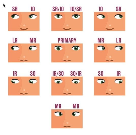 cranial nerve disorders figure_1