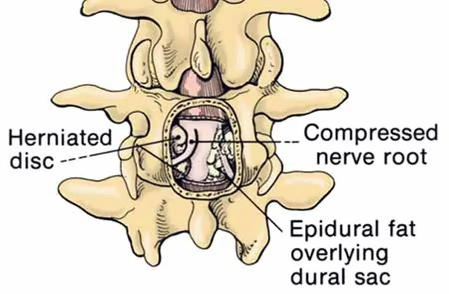 In a patient with the pathophysiologic process, which of the following would you expect to find on clinical examination?