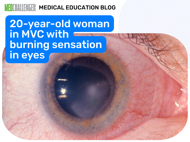 20-year-old woman in MVC with burning sensation in eyes quiz time