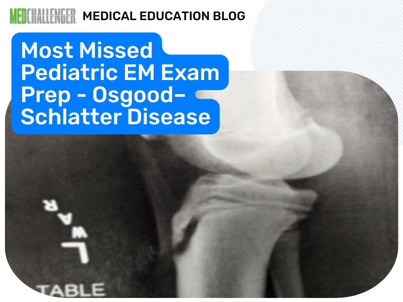 Most Missed PEM Question: Osgood-Schlatter Treatment