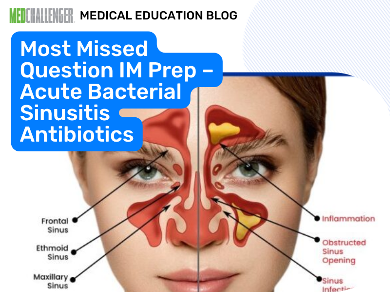 Most Missed IM Boards: Sinusitis Antibiotics vs Placebo