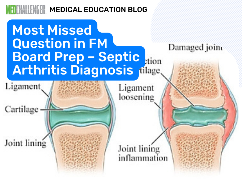 Most Missed: Septic Arthritis Diagnosis (Family Medicine Boards)