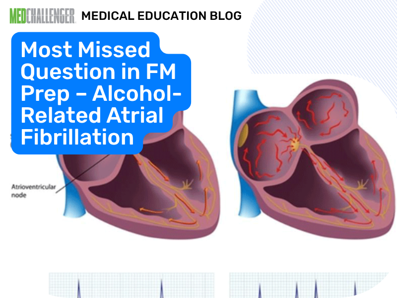 Most Missed Family Medicine Boards: Holiday Heart AF