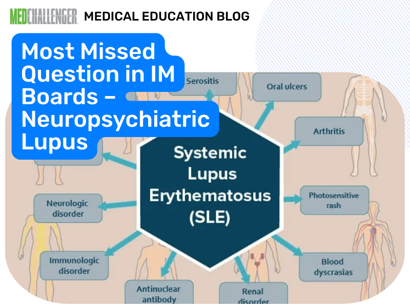 Most Missed IM Boards: Neuropsychiatric Lupus Testing