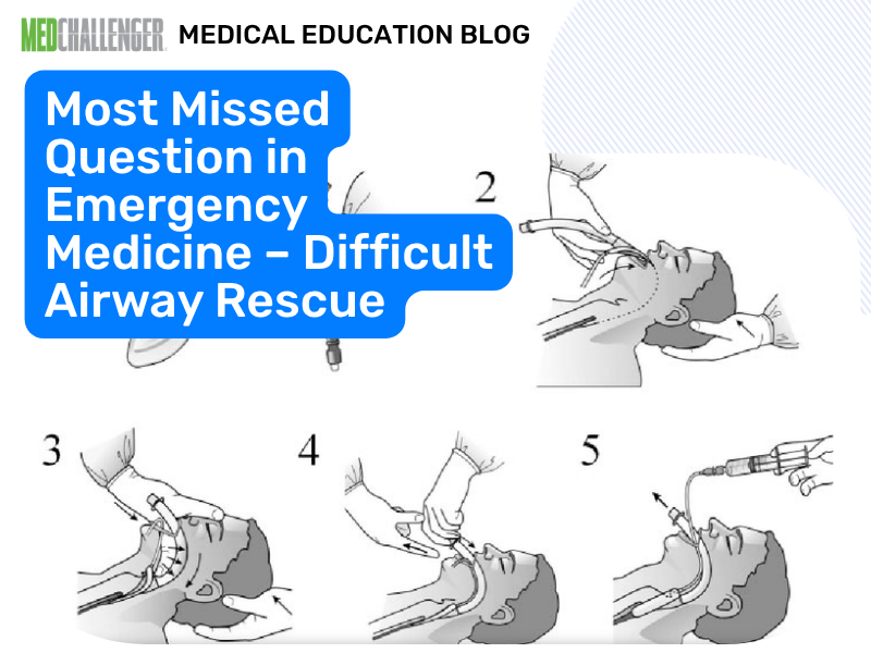 Most Missed EM Question: Difficult Airway—SGA Rescue