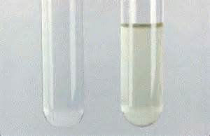 Lumbar puncture on a patient with suspected meningitis