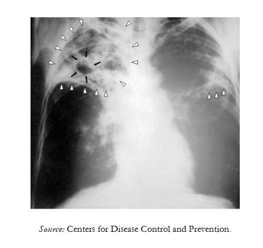 Findings of a radiograph