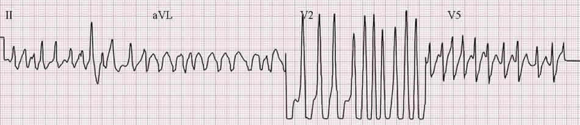 48-year-old man presents to you complaining of palpitations