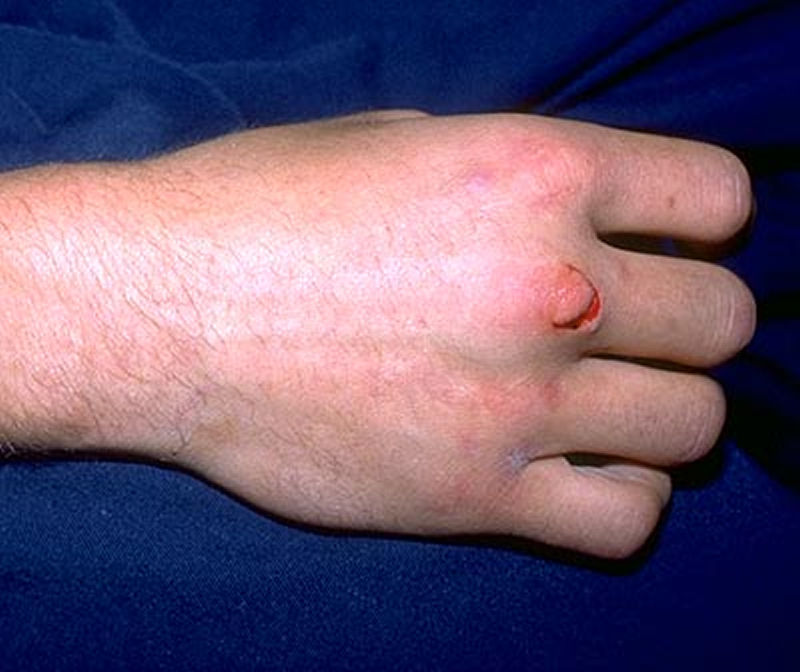 32-year-old man presents with an injury to his hand